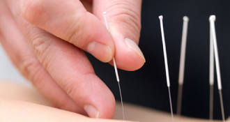 Bệnh Parkinson có nên châm cứu không? Cần lưu ý gì?